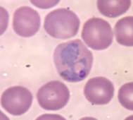 ����:P vivax trophozoite4.jpg