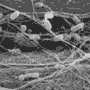 E. Coli O157:H7