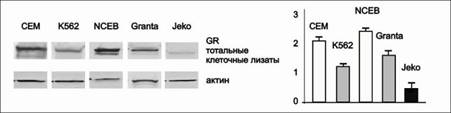 gr level