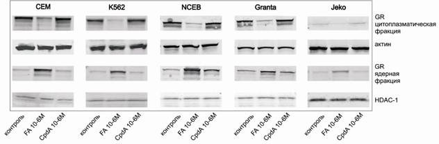 fig 13 GR translocation after CpdA