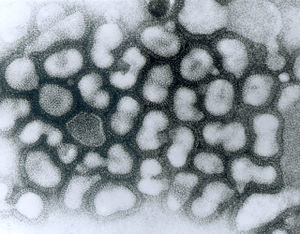 Influenza