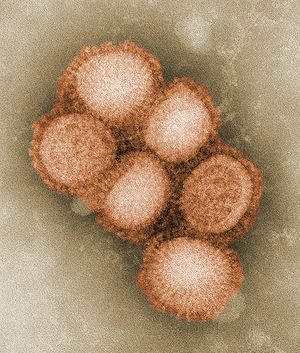 http://upload.wikimedia.org/wikipedia/commons/thumb/8/8b/CDC-11214-swine-flu.jpg/300px-CDC-11214-swine-flu.jpg
