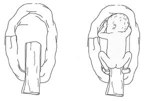Position 1