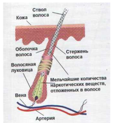 ris4