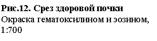 �������: