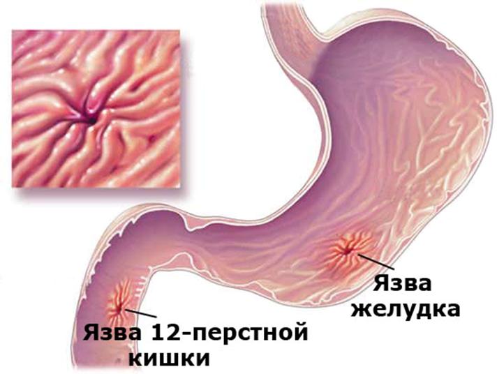 Картинка 1 из 3403