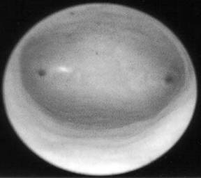 hysteroscopy%20normal