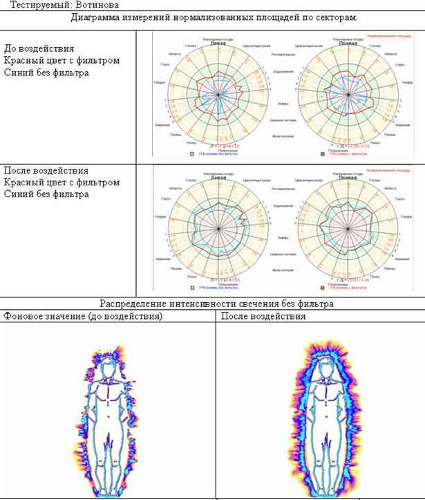 До и после посещения шунгитовой комнаты