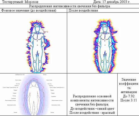 До шунгитовой комнаты и после посещения шунгитовой комнаты