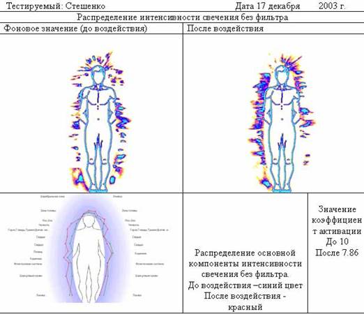 До шунгитовой комнаты и после посещения шунгитовой комнаты