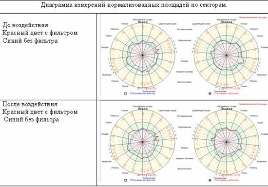 До и после посещения шунгитовой комнаты