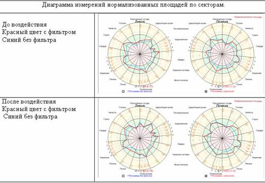 До и после посещения шунгитовой комнаты