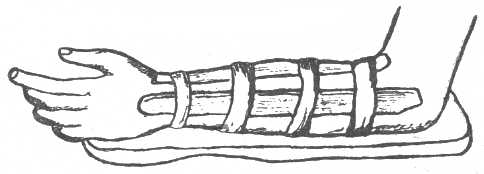 ���. 415.