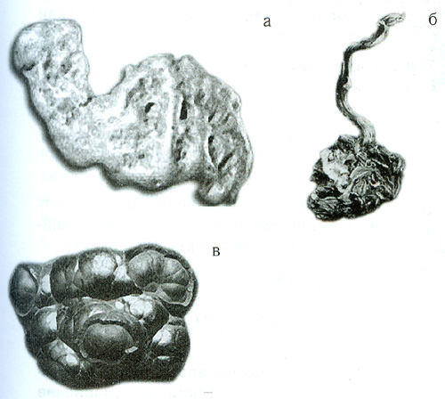 pic1