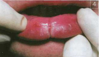 http://*****/img/2101-6.jpg