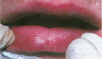 http://*****/img/2101-8.jpg