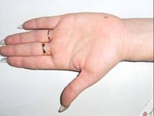 47030