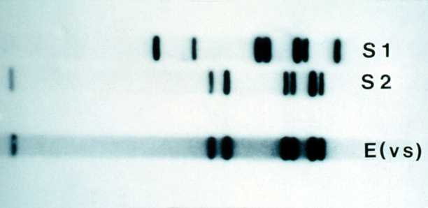 DNA Fingerprinting
