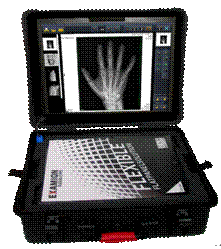 EXAMION_flexible_case.tif