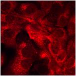 Exp 233 HaCaT sam1 5 ug 100x3