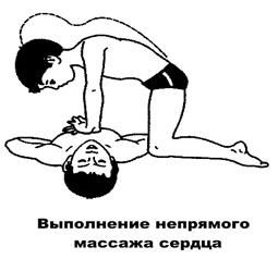 E:\Кольцов\Безопасность на воде\Памятки\Кратинки оказания первой мед.помощи\004.png