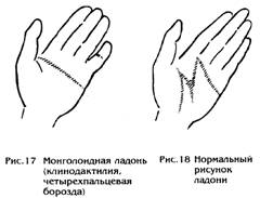 File0012