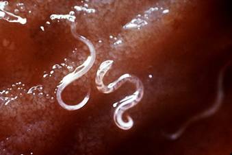 �������� (Nematode)