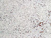http://*****/images/production/roofage/antisleet/hl_kalc.jpg