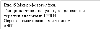 Подпись:
