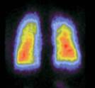 LUNG1