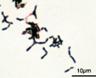 ����:Bifidobacterium adolescentis Gram.jpg