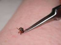 http://*****/uploads/posts/2012-05/_tickremovaltweezers1hr_0_21.jpg
