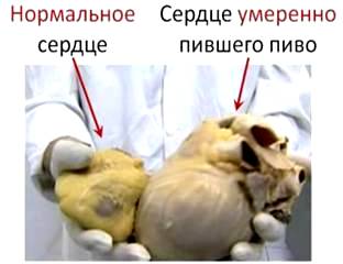 http://infarkty.net/pictures/interesno/%5b70%5d_interesno_pivo_i_serdze1.jpg