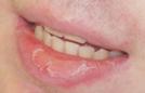 heilit5