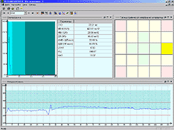 http://www.medicom-mtd.com/images/brief_information/psy_scr03.gif