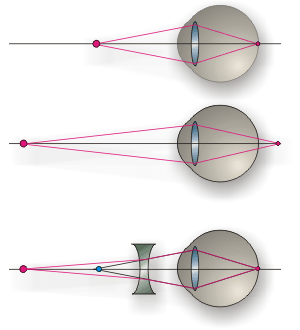 http://*****/theory/tema-12/12p-i4.gif