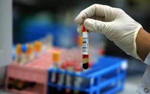 C:\Users\�������\Desktop\examedesangue600-size-598.jpg