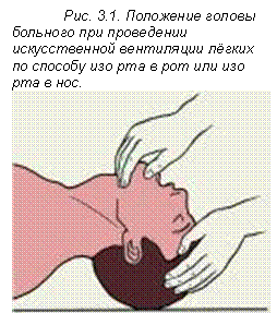 �������: