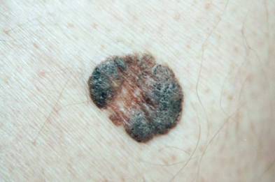 Image2