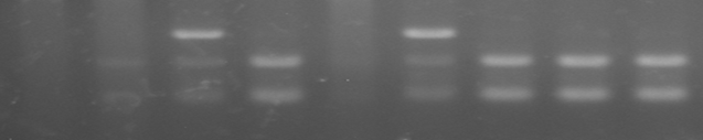 RYR -1