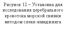 Подпись: