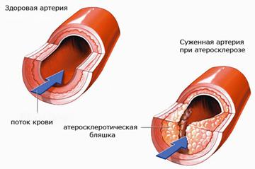 http://*****/wp-content/uploads/2012/01/atero2.jpg