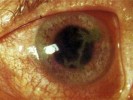 &Gcy;&iecy;&rcy;&pcy;&iecy;&tcy;&icy;&chcy;&iecy;&scy;&kcy;&icy;&jcy; &dcy;&rcy;&iecy;&vcy;&ocy;&vcy;&icy;&dcy;&ncy;&ycy;&jcy; &kcy;&iecy;&rcy;&acy;&tcy;&icy;&tcy; &fcy;&ocy;&tcy;&ocy;