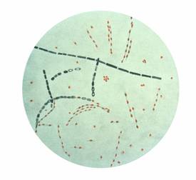 275px-bacillus_anthracis