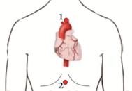 ��������: ��������: m Cardiocode