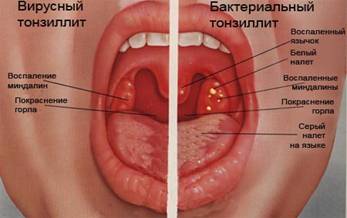 9a4530d8639c8d8df466b700db99c797.jpg