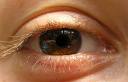 ���� : eye