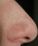 ���� : nose