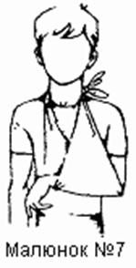 pd6