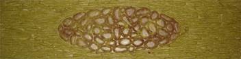 zabor_galka